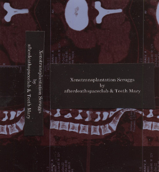 Xenotransplantation Scruggs